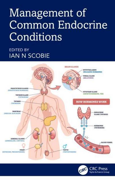 Management of Common Endocrine Conditions