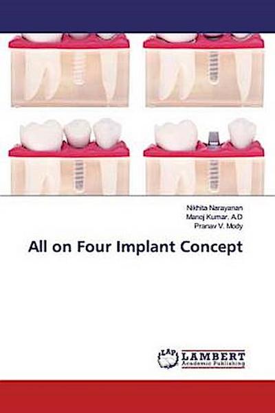 All on Four Implant Concept