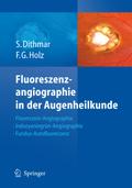 Fluoreszenzangiographie in der Augenheilkunde