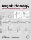 Brugada Phenocopy