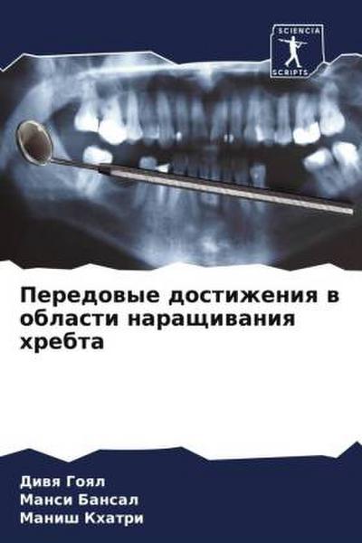 Peredowye dostizheniq w oblasti naraschiwaniq hrebta