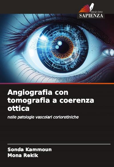 Angiografia con tomografia a coerenza ottica