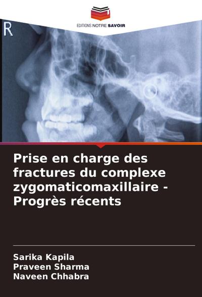 Prise en charge des fractures du complexe zygomaticomaxillaire - Progrès récents