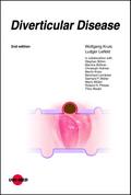 Diverticular Disease