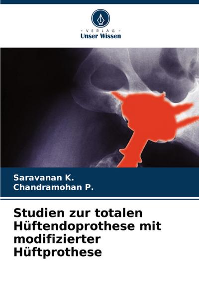 Studien zur totalen Hüftendoprothese mit modifizierter Hüftprothese