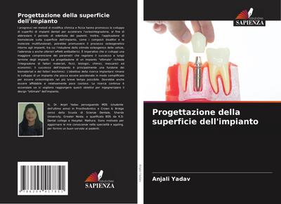 Progettazione della superficie dell’impianto