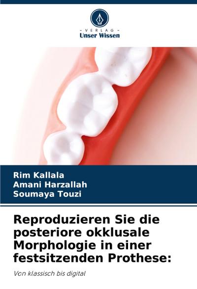 Reproduzieren Sie die posteriore okklusale Morphologie in einer festsitzenden Prothese: