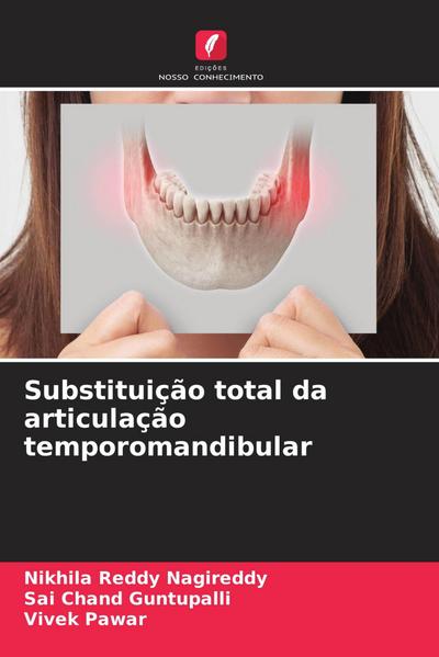 Substituição total da articulação temporomandibular