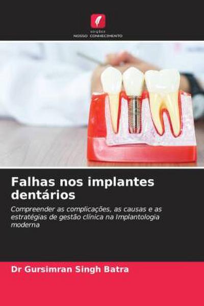 Falhas nos implantes dentários
