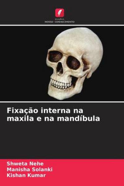 Fixação interna na maxila e na mandíbula