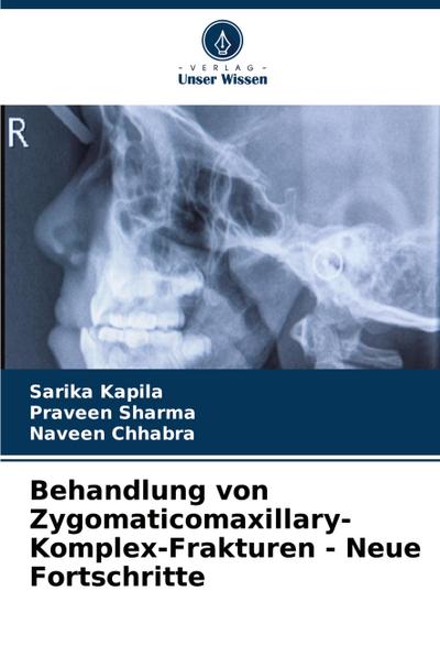 Behandlung von Zygomaticomaxillary-Komplex-Frakturen - Neue Fortschritte