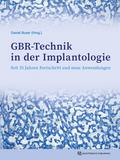 GBR-Technik in der Implantologie von Daniel Buser | Buch