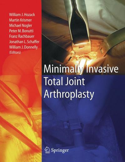 Minimally Invasive Total Joint Arthroplasty