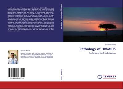 Pathology of HIV/AIDS