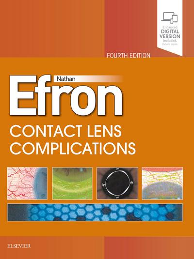 Contact Lens Complications E-Book