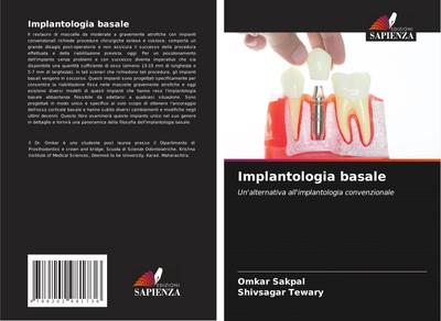 Implantologia basale