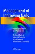 Management of Ingrowing Nails
