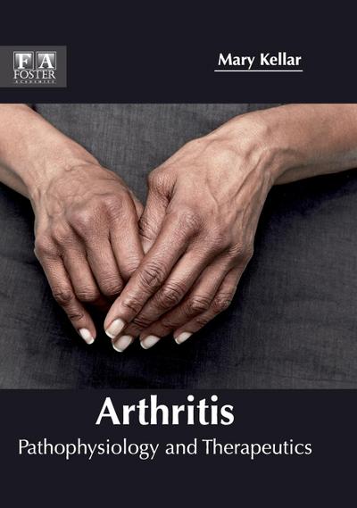 Arthritis