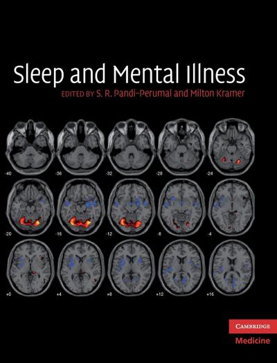 Sleep and Mental Illness