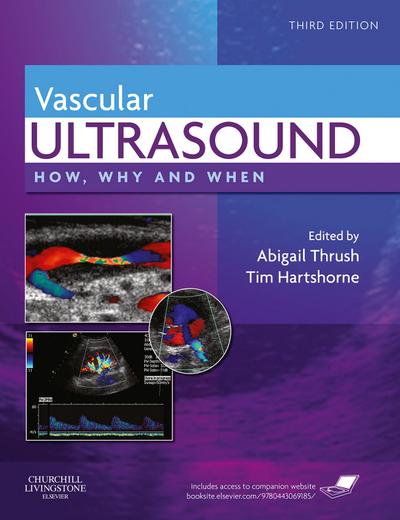 Vascular Ultrasound