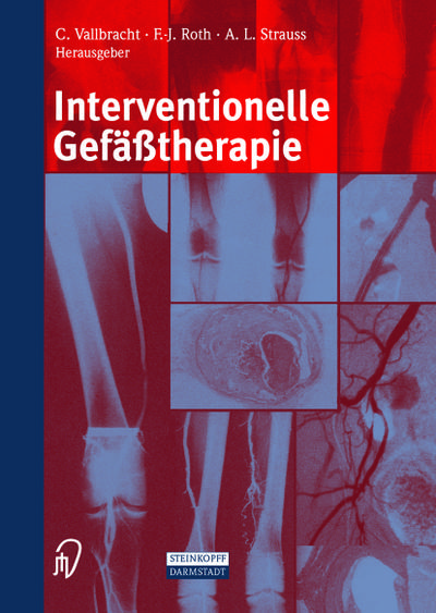 Interventionelle Gefäßtherapie (German Edition)