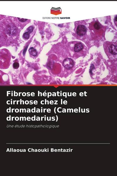Fibrose hépatique et cirrhose chez le dromadaire (Camelus dromedarius)