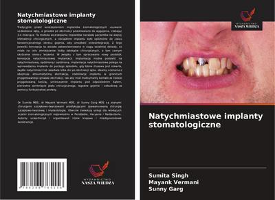 Natychmiastowe implanty stomatologiczne