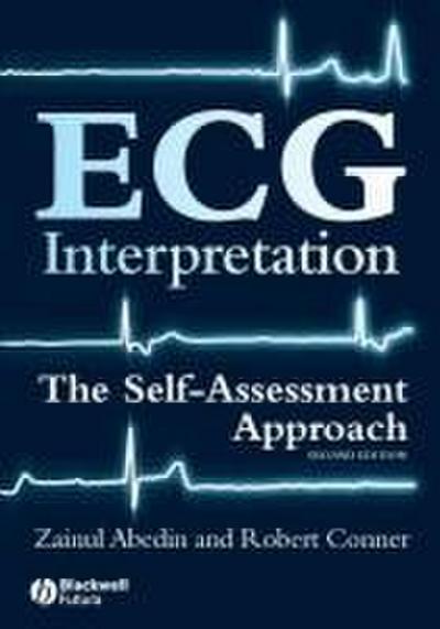 ECG Interpretation