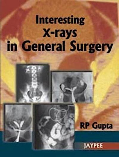 Gupta, R: Interesting X-Rays in General Surgery