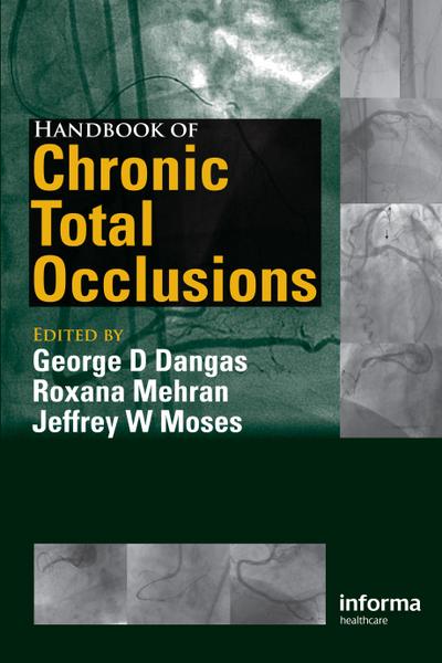 Handbook of Chronic Total Occlusions