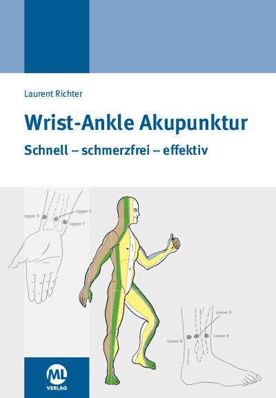 Wrist-Ankle Akupunktur 