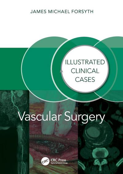 Vascular Surgery