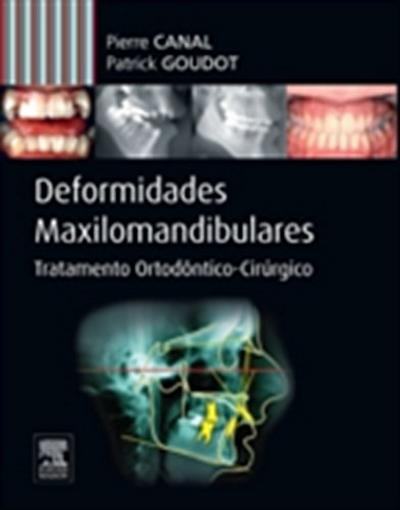 Deformidades Maxilo-mandibulares
