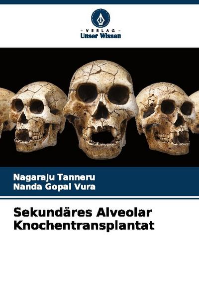 Sekundäres Alveolar Knochentransplantat