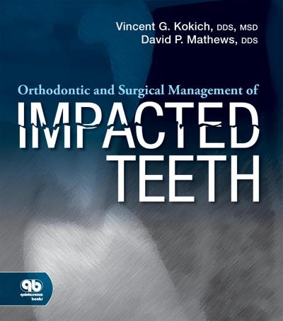 Orthodontic and Surgical Management of Impacted Teeth (eBook, PDF) - Vincent G. Kokich