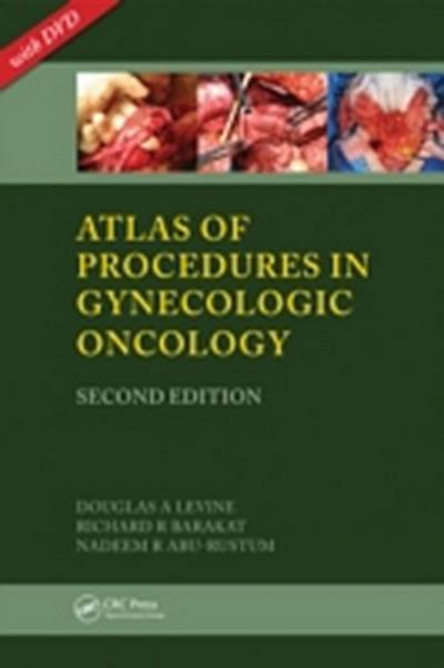 Atlas of Procedures in Gynecologic Oncology