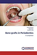 Bone grafts in Periodontics