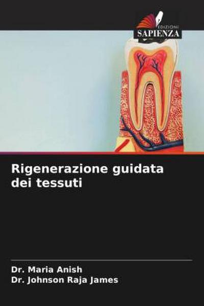 Rigenerazione guidata dei tessuti