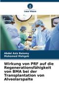 Wirkung von PRF auf die Regenerationsfähigkeit von BMA bei der Transplantation von Alveolarspalte