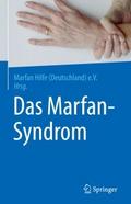 Das Marfan-Syndrom