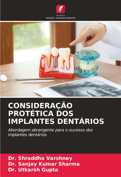CONSIDERAÇÃO PROTÉTICA DOS IMPLANTES DENTÁRIOS