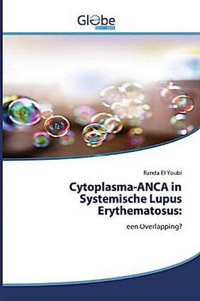 Cytoplasma-ANCA in Systemische Lupus Erythematosus: