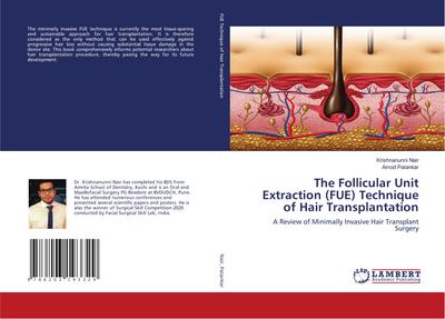 The Follicular Unit Extraction (FUE) Technique of Hair Transplantation
