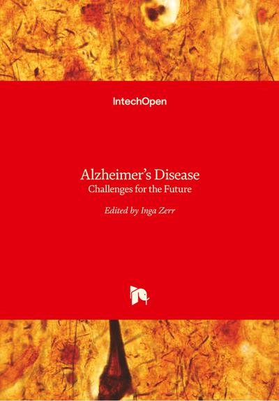 Alzheimer’s Disease