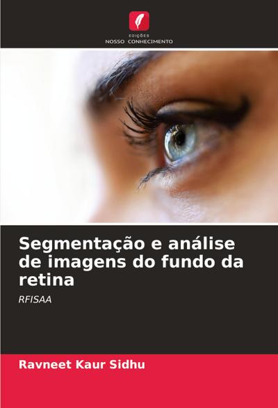 Segmentação e análise de imagens do fundo da retina