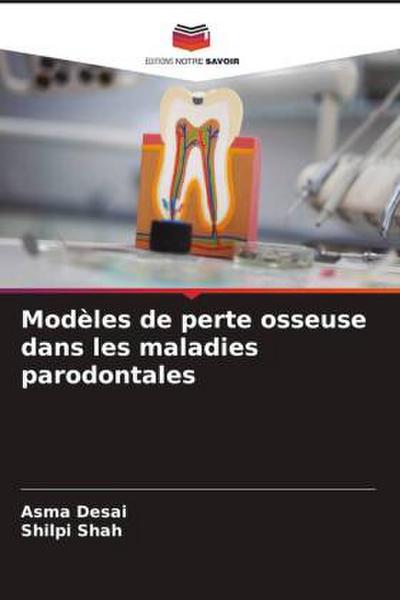 Modèles de perte osseuse dans les maladies parodontales