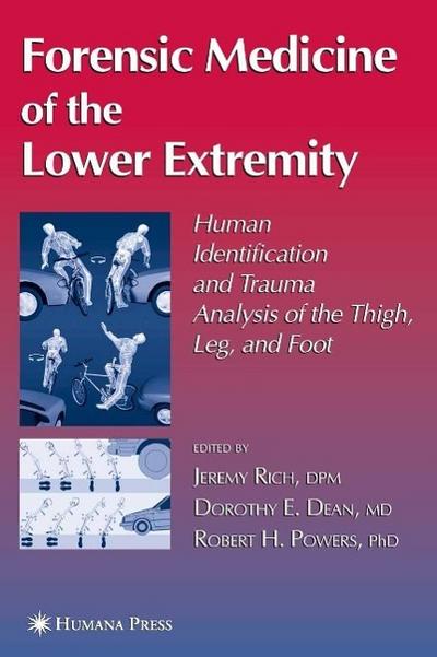 Forensic Medicine of the Lower Extremity