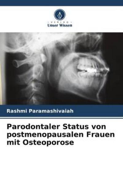 Parodontaler Status von postmenopausalen Frauen mit Osteoporose