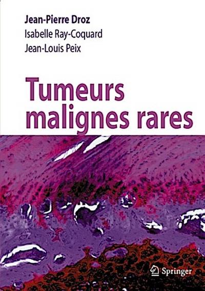 Tumeurs malignes rares