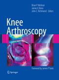 Knee Arthroscopy